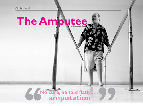 prostituée amputée